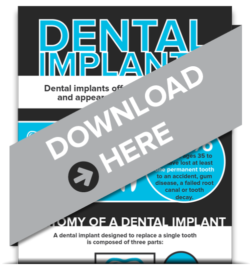 Dental Implants Marysville OH
